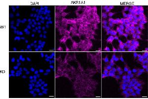 Immunocytochemical staining of HeLa cells using AKR1A1 antibody (ABIN7797569), 1:1,000), Top panel: wild-type (WT), Bottom panal: AKR1A1 shRNA knockdown (KD). (AKR1A1 Antikörper)