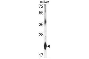 Western blot analysis of DHFR antibody (C-term) in mouse liver tissue lysates (35ug/lane). (Dihydrofolate Reductase Antikörper  (C-Term))