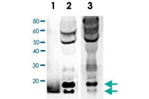 Western blot analysis of BDNF expression in human serum. (BDNF Antikörper)