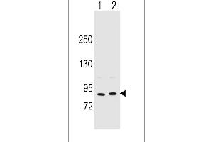 Western blot analysis in MCF-7(lane 1),A375(lane 2) cell line lysates (35ug/lane). (Periostin Antikörper  (C-Term))