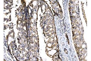 IHC analysis of Sigma1-Receptor/SIGMAR1 using anti-Sigma1-Receptor/SIGMAR1 antibody (ABIN7599011). (SIGMAR1 Antikörper  (AA 1-154))