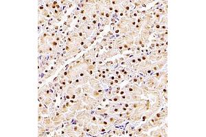 Immunohistochemistry of paraffin embedded rat kidney using ZHX3 (ABIN7076287) at dilution of 1:700 (400x lens) (ZHX3 Antikörper)