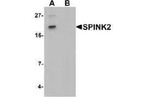 Western blot analysis of SPINK2 in mouse heart tissue lysate with SPINK2 Antibody  at 1 ug/mL in (A) the absence and (B) the presence of blocking peptide. (SPINK2 Antikörper  (C-Term))