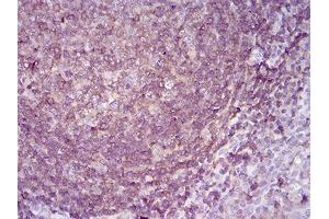 Immunohistochemistry (IHC) image for anti-Amyloid beta (A4) Precursor Protein-Binding, Family B, Member 1 Interacting Protein (APBB1IP) (AA 1-151) antibody (ABIN5542483)