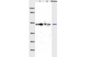 Lane 1: mouse brain lysates Lane 2: mouse embryo lysates probed with Anti phospho-C-Myc(Thr358) Polyclonal Antibody, Unconjugated (ABIN752593) at 1:200 in 4 °C. (c-MYC Antikörper  (pThr358))