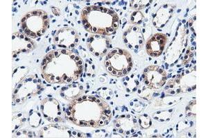 Immunohistochemical staining of paraffin-embedded Human liver tissue using anti-QPRT mouse monoclonal antibody. (QPRT Antikörper)