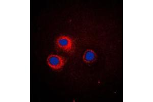 Immunofluorescent analysis of CD1e staining in HeLa cells. (CD1e Antikörper  (Center))