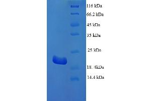 SDS-PAGE (SDS) image for Tau1 (LOC101055581) (AA 24-195) protein (His tag) (ABIN5714056) (Tau1 Protein (LOC101055581) (AA 24-195) (His tag))