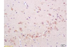 Formalin-fixed and paraffin embedded rat brain labeled with Anti-phospho-STMN2/SCG10 (Ser50) Polyclonal Antibody, Unconjugated (ABIN1714035) at 1:200 followed by conjugation to the secondary antibody and DAB staining