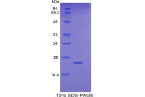 SDS-PAGE analysis of Human RBP5 Protein. (Retinol Binding Protein 5 Protein)
