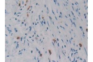 Immunohistochemistry (IHC) image for anti-Regenerating Islet Derived Protein 3 gamma (REG3g) (AA 39-175) antibody (ABIN7435838)