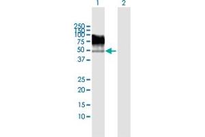 Western Blot analysis of TRIM55 expression in transfected 293T cell line by TRIM55 MaxPab polyclonal antibody. (TRIM55 Antikörper  (AA 1-452))