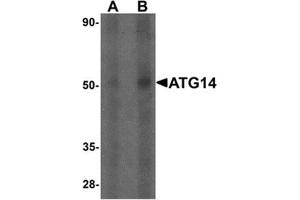 Western blot analysis of ATG14 in human small intestine tissue lysate with ATG14 Antibody  at (A) 1 and (B) 2 µg/mL. (ATG14 Antikörper  (Middle Region))