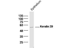 Mouse epithelium lysates probed with Keratin 39 Polyclonal Antibody, Unconjugated  at 1:300 dilution and 4˚C overnight incubation.