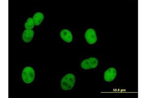 Immunofluorescence of purified MaxPab antibody to PMS2 on HeLa cell. (PMS2 Antikörper  (AA 1-862))