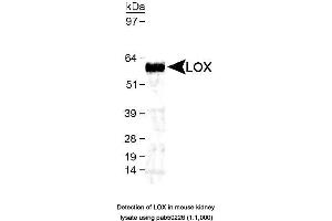 Image no. 1 for anti-Lysyl Oxidase (LOX) (AA 200-300), (AA 300-400) antibody (ABIN363535) (LOX Antikörper  (AA 200-300, AA 300-400))
