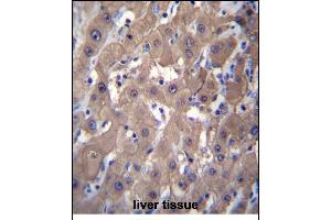 AKR1C2 Antibody (C-term) (ABIN656180 and ABIN2845509) immunohistochemistry analysis in formalin fixed and paraffin embedded human liver tissue followed by peroxidase conjugation of the secondary antibody and DAB staining. (AKR1C2 Antikörper  (C-Term))