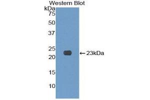 Western Blotting (WB) image for anti-Killer Cell Lectin-Like Receptor Subfamily C, Member 2 (KLRC2) (AA 19-190) antibody (ABIN1859564)