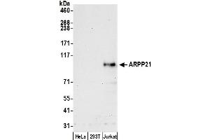 anti-cAMP-Regulated phosphoprotein, 21kDa (ARPP21) (AA 1-50) antibody