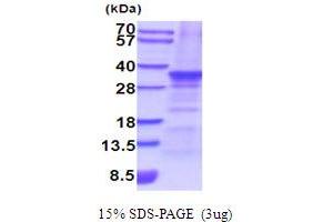 SDS-PAGE (SDS) image for Snail Family Zinc Finger 2 (SNAI2) (AA 1-268) protein (His tag) (ABIN5854222) (SLUG Protein (AA 1-268) (His tag))