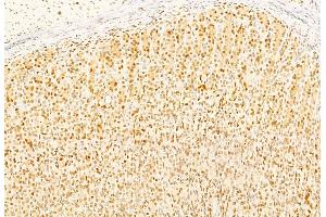 ABIN6260481 and ABIN6269253 at 1/100 staining Rat stomach tissue by IHC-P.