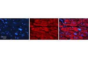 Rabbit Anti-GNS Antibody   Formalin Fixed Paraffin Embedded Tissue: Human heart Tissue Observed Staining: Cytoplasmic Primary Antibody Concentration: 1:100 Other Working Concentrations: N/A Secondary Antibody: Donkey anti-Rabbit-Cy3 Secondary Antibody Concentration: 1:200 Magnification: 20X Exposure Time: 0.