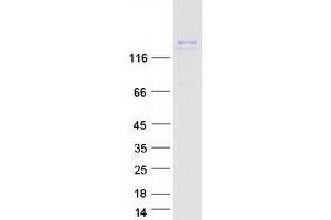 Western Blotting (WB) image for Insulin Receptor-Related Receptor (INSRR) protein (Myc-DYKDDDDK Tag) (ABIN2723504)