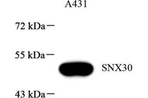Western blot analysis of SNX30 (ABIN7075693),at dilution of 1: 1000