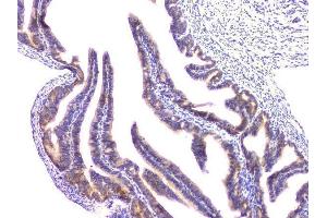 IHC analysis of RAB11B using anti-RAB11B antibody (ABIN6719364). (RAB11B Antikörper)