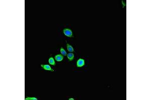 Immunofluorescent analysis of HepG2 cells using ABIN7160637 at dilution of 1:100 and Alexa Fluor 488-congugated AffiniPure Goat Anti-Rabbit IgG(H+L) (SET Binding Factor 2 Antikörper  (AA 1585-1813))