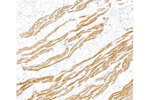 Immunohistochemistry (IHC) image for anti-Troponin I (TNNI) (AA 1-50) antibody (ABIN7795680)