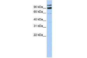 LONRF3 antibody used at 1 ug/ml to detect target protein. (LONRF3 Antikörper  (Middle Region))