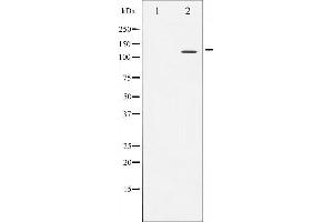 Western blot analysis of NFAT4 expression in HeLa whole cell lysates,The lane on the left is treated with the antigen-specific peptide. (NFATC3 Antikörper  (N-Term))
