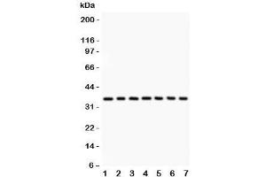 Western blot testing of IkBa antibody and Lane 1:  rat brain;  2: mouse brain;  3: (r) kidney;  4: (m) kidney;  5: human 293T;  6: (h) Jurkat;  7: (h) Raji lysate.