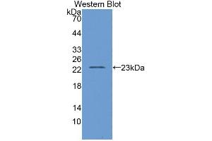 Western blot analysis of the recombinant protein. (D2HGDH Antikörper  (AA 56-232))