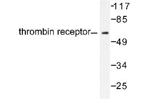 Image no. 1 for anti-Thyroid Hormone Receptor, alpha (THRA) antibody (ABIN271852)