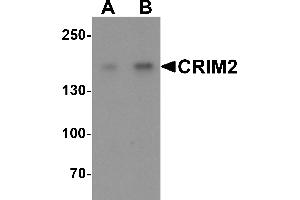 Western blot analysis of CRIM2 in Jurkat cell lysate with CRIM2 antibody at (A) 1 and (B) 2 µg/mL. (KCP Antikörper  (C-Term))