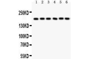 Western Blotting (WB) image for anti-Pregnancy-Associated Plasma Protein A, Pappalysin 1 (PAPPA) (AA 95-388) antibody (ABIN3043377) (PAPPA Antikörper  (AA 95-388))