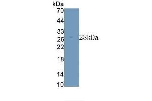 Detection of Recombinant ODC,Mouse using Polyclonal Antibody to Ornithine Decarboxylase (ODC) (ODC1 Antikörper)
