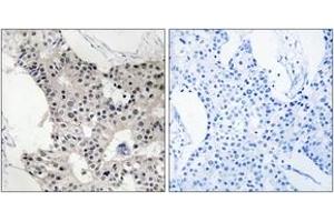Immunohistochemistry (IHC) image for anti-B Melanoma Antigen Family, Member 4 (BAGE4) (AA 9-58) antibody (ABIN2890154)