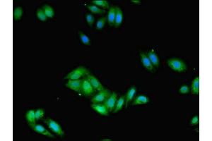 Immunofluorescent analysis of HepG2 cells using ABIN7155188 at dilution of 1:100 and Alexa Fluor 488-congugated AffiniPure Goat Anti-Rabbit IgG(H+L) (FCER1G Antikörper  (AA 19-86))