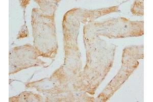 Immunohistochemistry of paraffin-embedded human skeletal muscle tissue using ABIN7149014 at dilution of 1:100 (CSRP3 Antikörper  (AA 1-194))