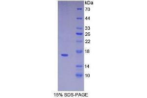 SDS-PAGE analysis of Mouse VPREB1 Protein. (VPREB1 Protein)