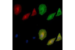 ABIN7095093 and ABIN7099149 staining  cells by IF/ICC.