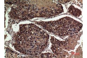 Immunohistochemistry (IHC) analysis of paraffin-embedded Human Lung, antibody was diluted at 1:100. (APOA1 Antikörper  (Internal Region))