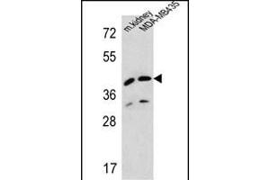 L2HGDH Antibody (Center) (ABIN654213 and ABIN2844053) western blot analysis in MDA-M cell line and mouse kidney tissue lysates (35 μg/lane).