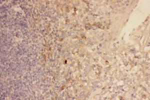 Immunohistochemistry (IHC) image for anti-Chemokine (C-X-C Motif) Receptor 3 (CXCR3) (AA 1-368) antibody (ABIN3042780)
