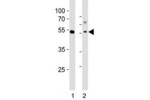 Western blot analysis of lysate from 1) human MCF-7 cell line and 2) mouse liver tissue tissue using Gata6 antibody at 1:1000. (GATA6 Antikörper  (C-Term))