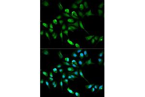 Immunofluorescence analysis of HepG2 cell using ADH5 antibody. (ADH5 Antikörper  (AA 1-374))