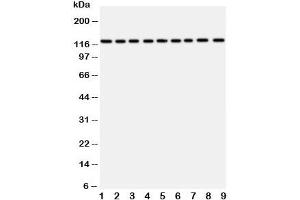 Western blot testing of TRPC3 antibody and Lane 1:  rat liver (TRPC3 Antikörper  (AA 836-851))